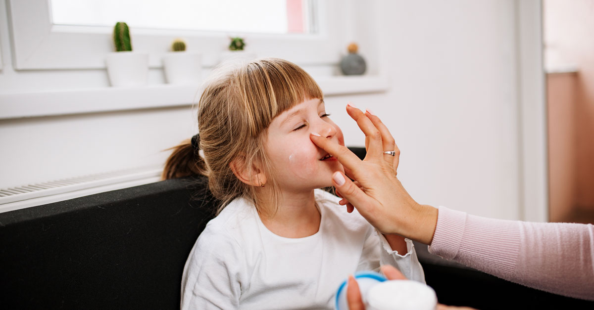 กลากน้ำนม