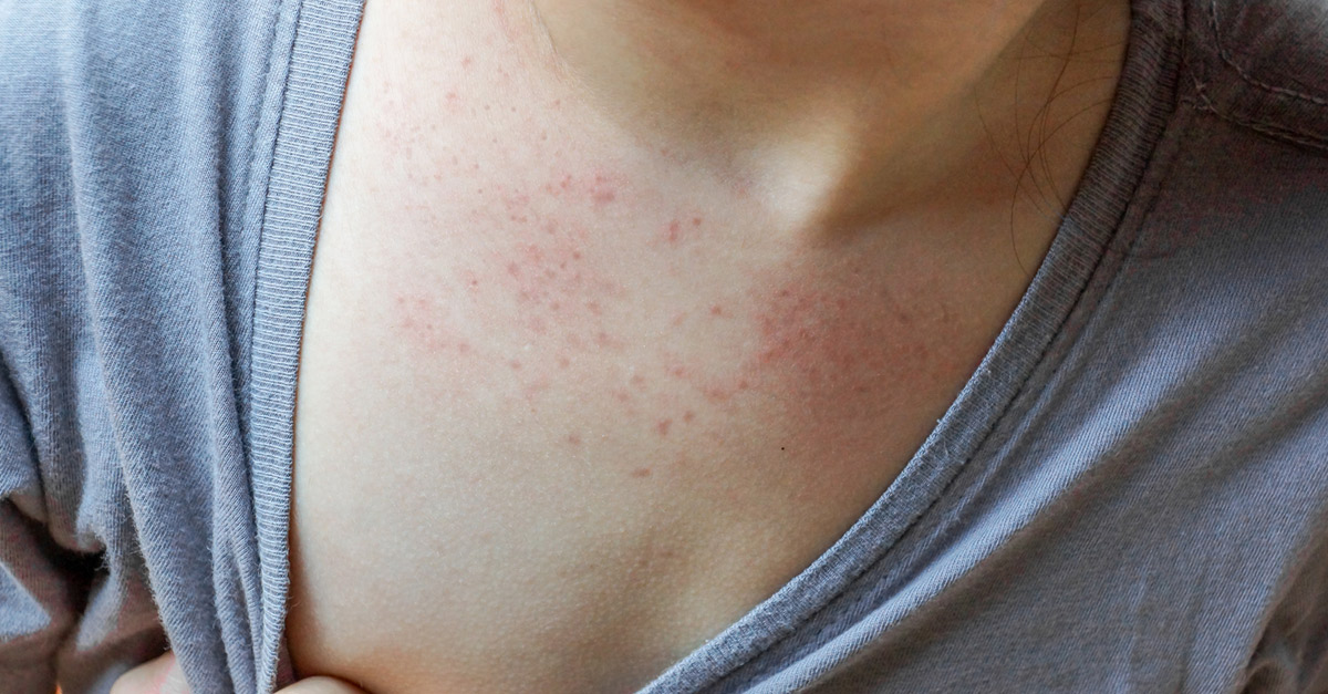 ไอทีพี,ITP