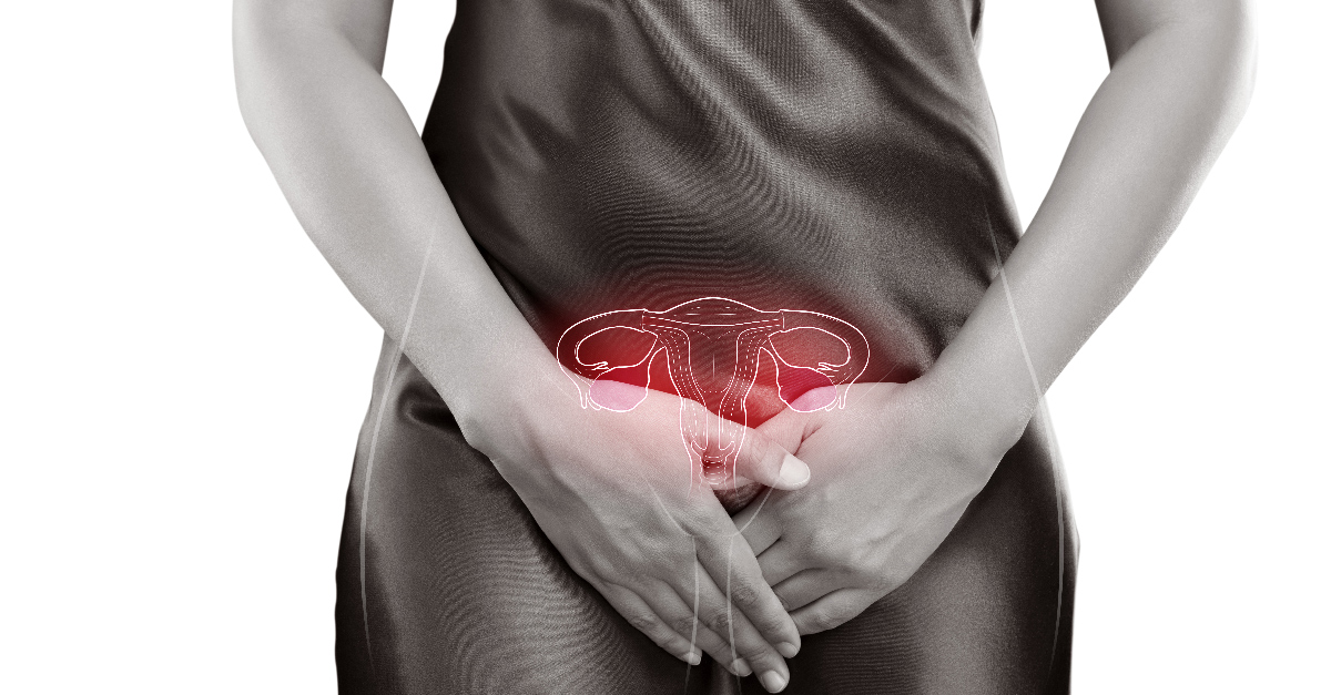 เนื้องอกรังไข่,ถุงน้ำรังไข่