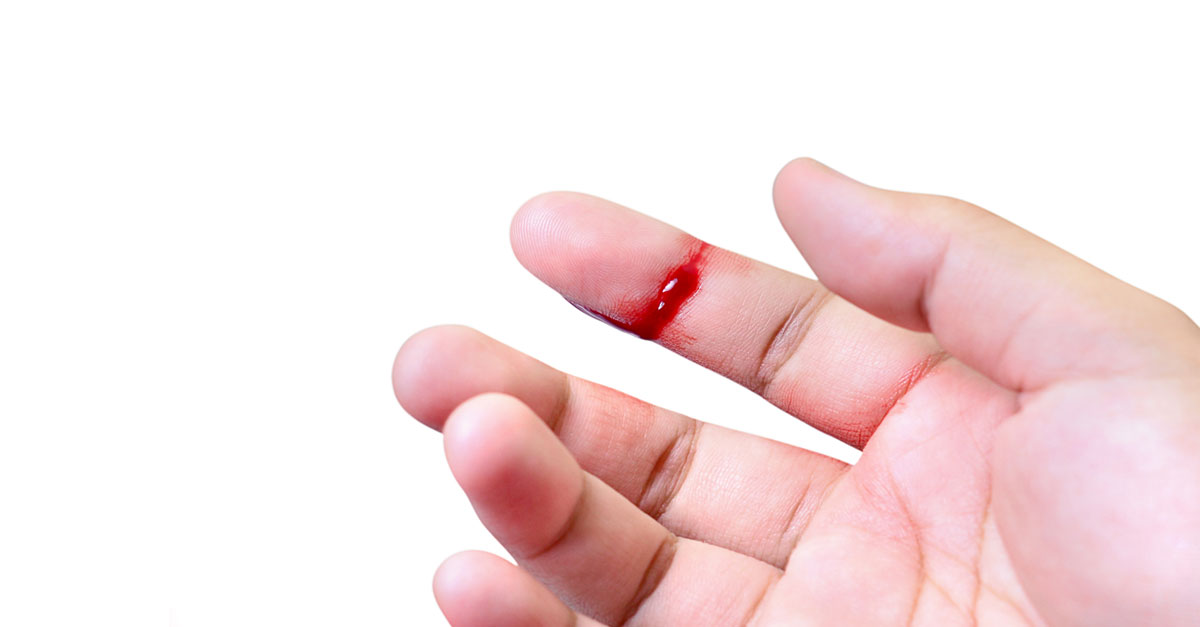 ฮีโมฟิเลีย,โรคเลือดไหลไม่หยุด