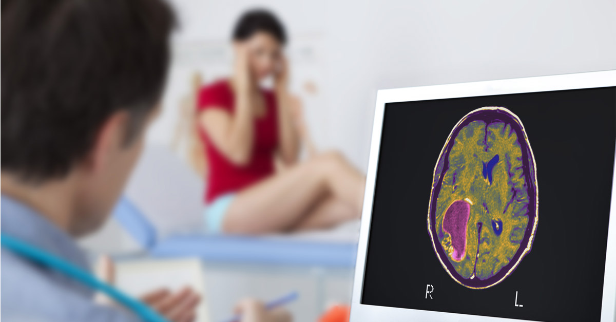 เนื้องอกสมอง