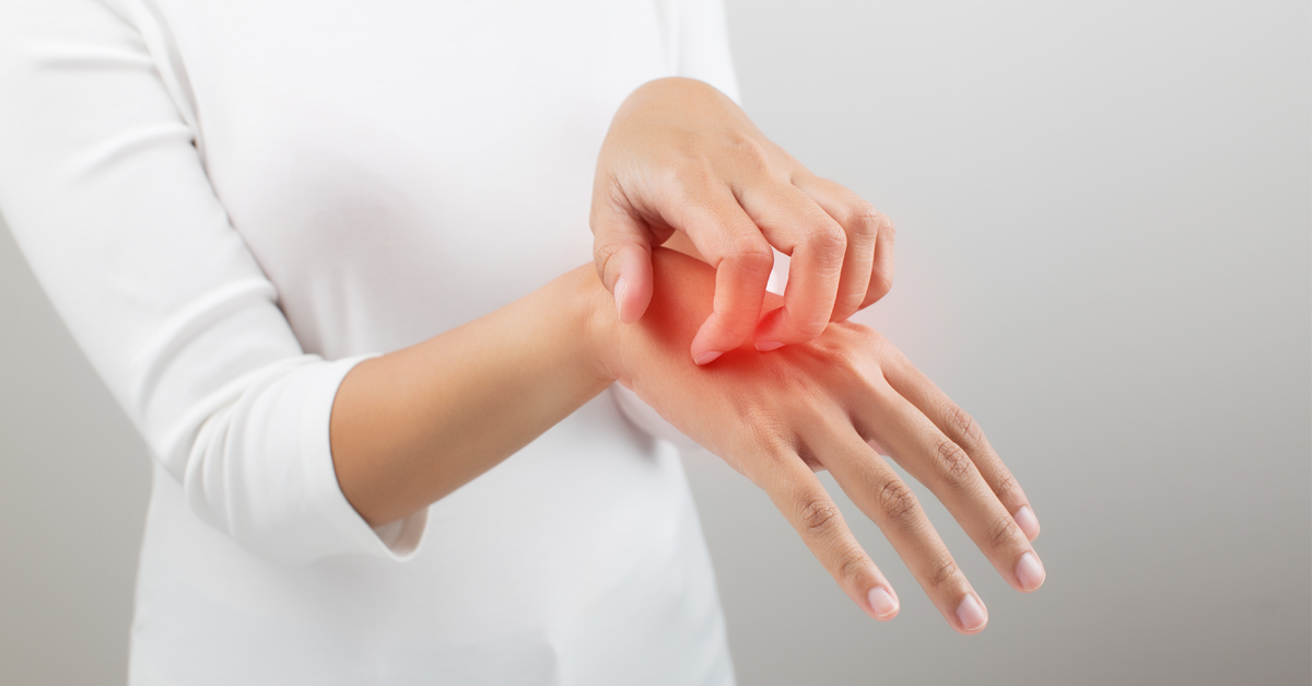 แผลพุพอง,พุพอง