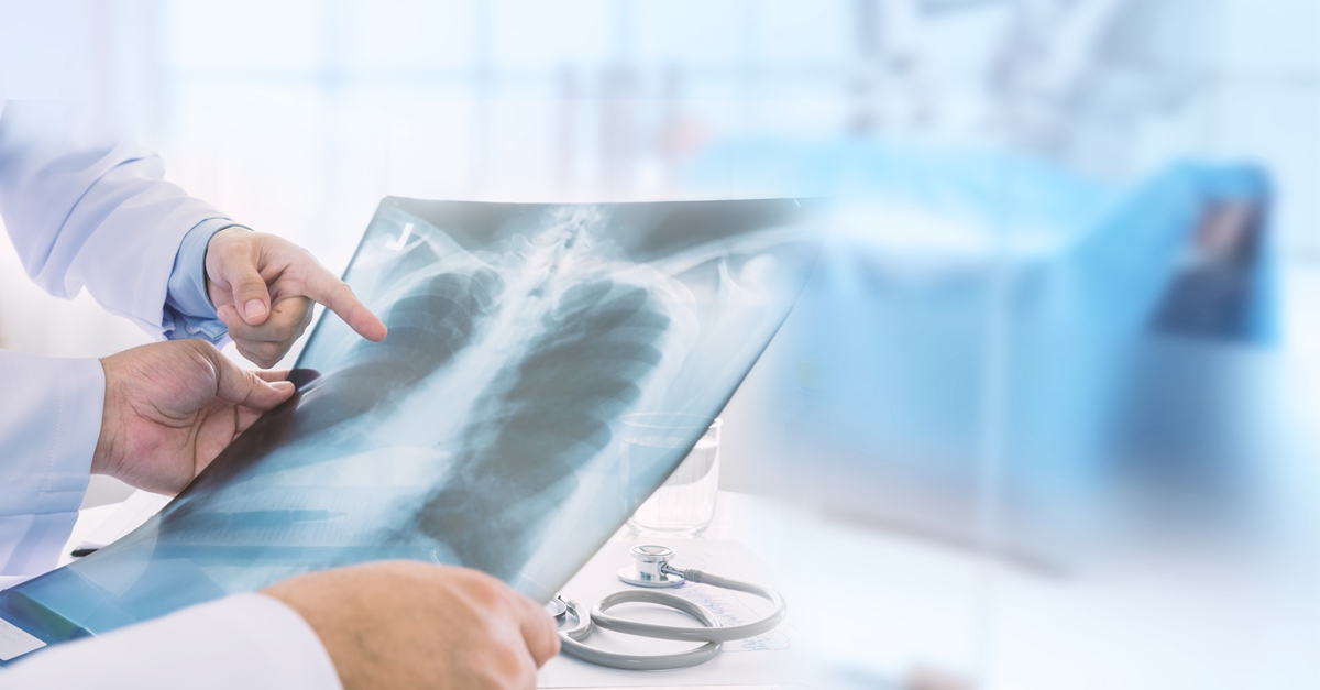 มะเร็งปอด