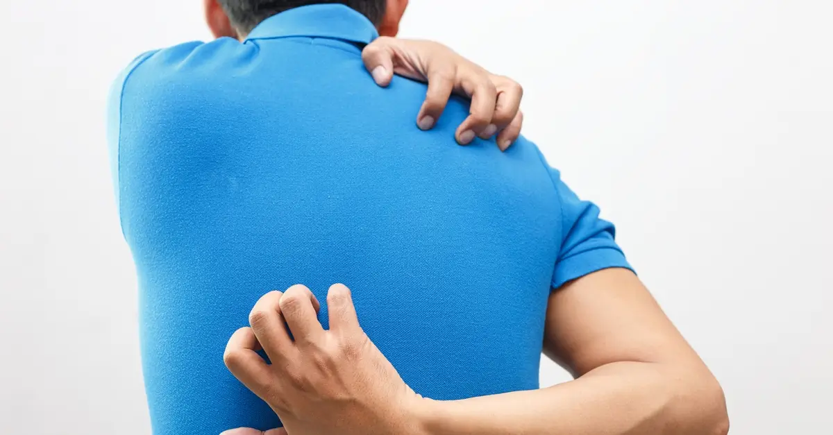 เกลื้อน