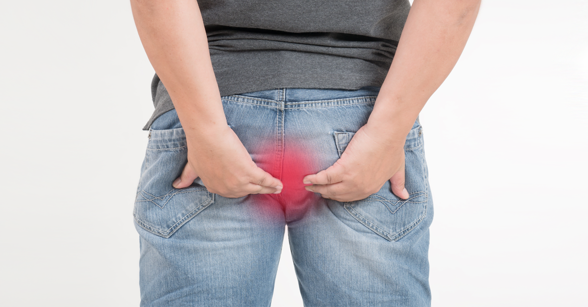 ฝีรอบทวารหนัก,ฝีคัณฑสูตร