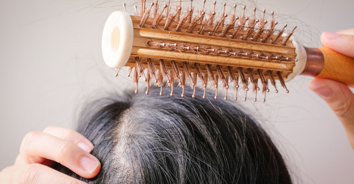 ผมร่วงจากการทำผม