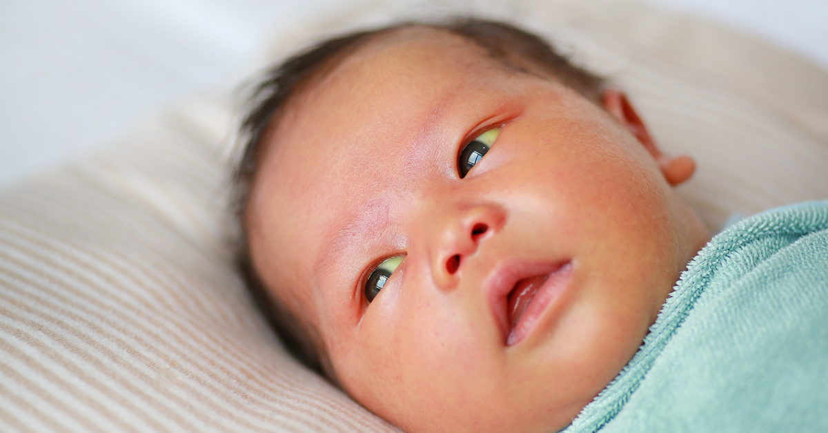 ท่อน้ำดีตีบตันในทารก