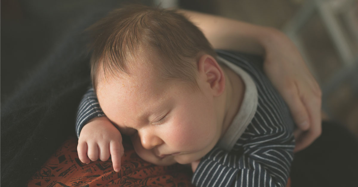 ผิวหนังอักเสบชนิดเกล็ดรังแค,ผิวหนังอักเสบ