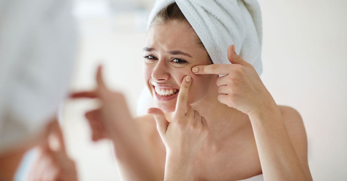 สิว,เป็นสิว