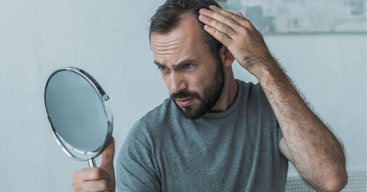 ผมร่วงตามธรรมชาติ,ผมร่วงธรรมชาติ