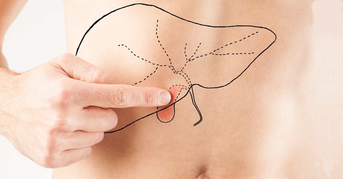 นิ่วน้ำดี,นิ่วในถุงน้ำดี,นิ่วถุงน้ำดี