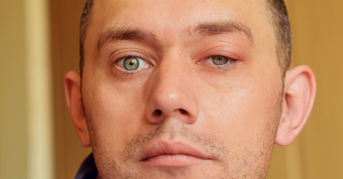 ฝี,ฝีฝักบัว