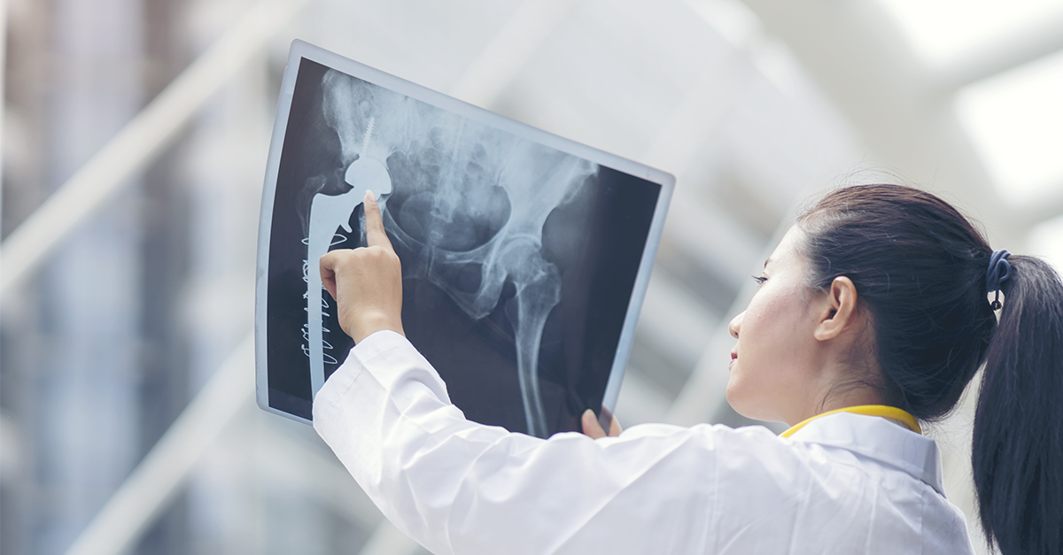 มะเร็งกระดูก