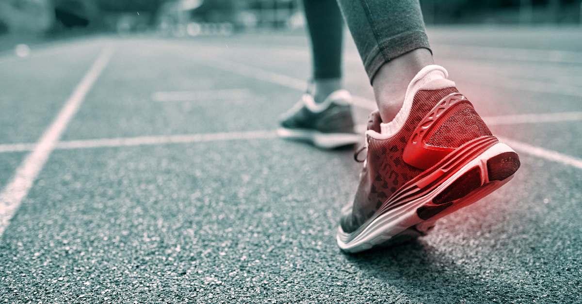 พังผืดส้นเท้าอักเสบ,เอ็นฝ่าเท้าอักเสบ,โรครองช้ำ