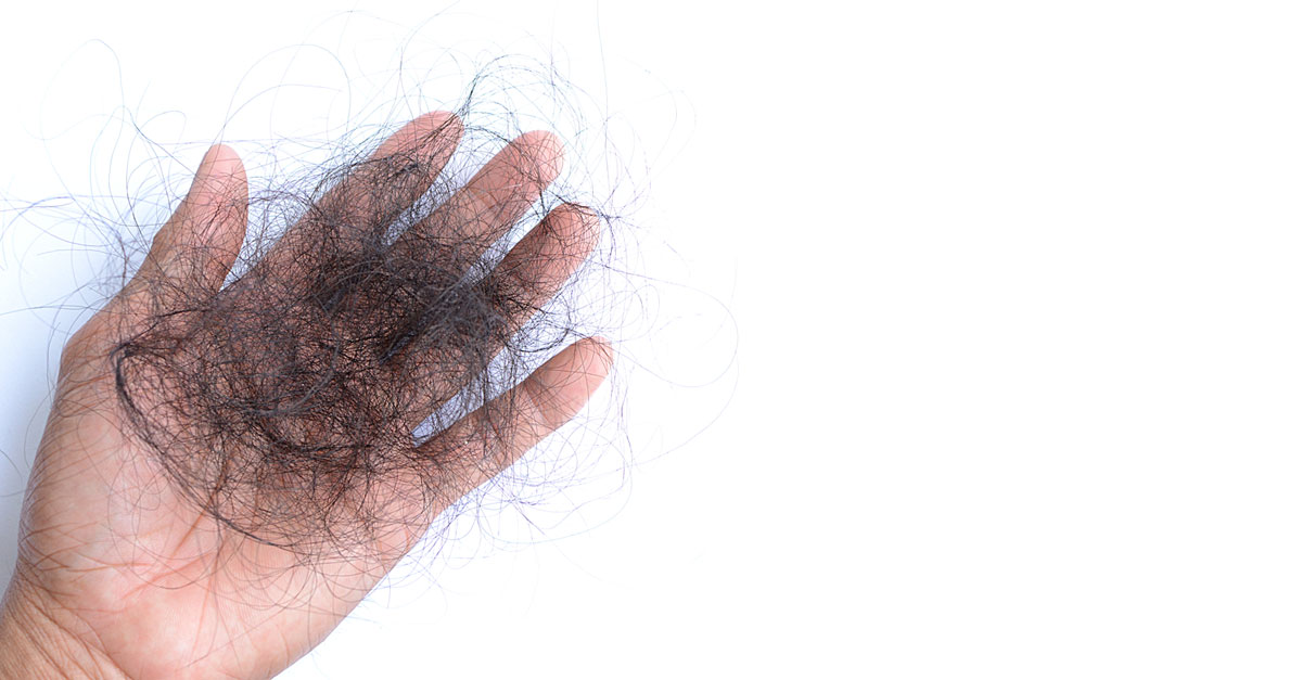 ผมร่วงจากซิฟิลิส