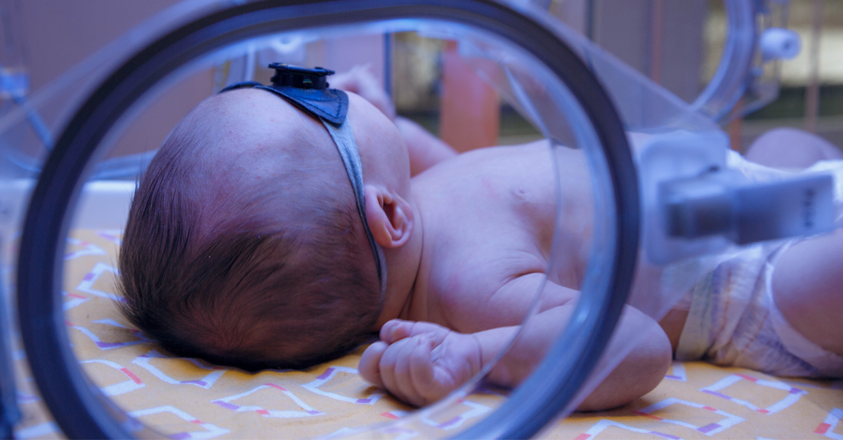 ดีซ่านสรีระในทารกแรกเกิด